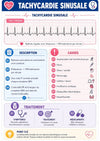 Guide Complet ECG en Médecine